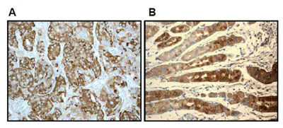 Immunohistochemistry (Formalin/PFA-fixed paraffin-embedded sections) - Anti-Estrogen Inducible Protein pS2 antibody [EPR3972] - BSA and Azide free (AB239908)