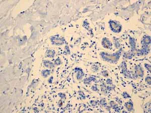 Immunohistochemistry (Formalin/PFA-fixed paraffin-embedded sections) - Anti-Estrogen Inducible Protein pS2 antibody [EPR3972] - BSA and Azide free (AB239908)