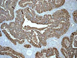 Immunohistochemistry (Formalin/PFA-fixed paraffin-embedded sections) - Anti-Estrogen Inducible Protein pS2 antibody [EPR3972] - BSA and Azide free (AB239908)