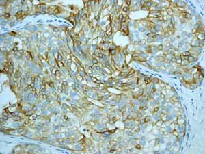 Immunohistochemistry (Formalin/PFA-fixed paraffin-embedded sections) - Anti-Estrogen Inducible Protein pS2 antibody [EPR3972] - BSA and Azide free (AB239908)