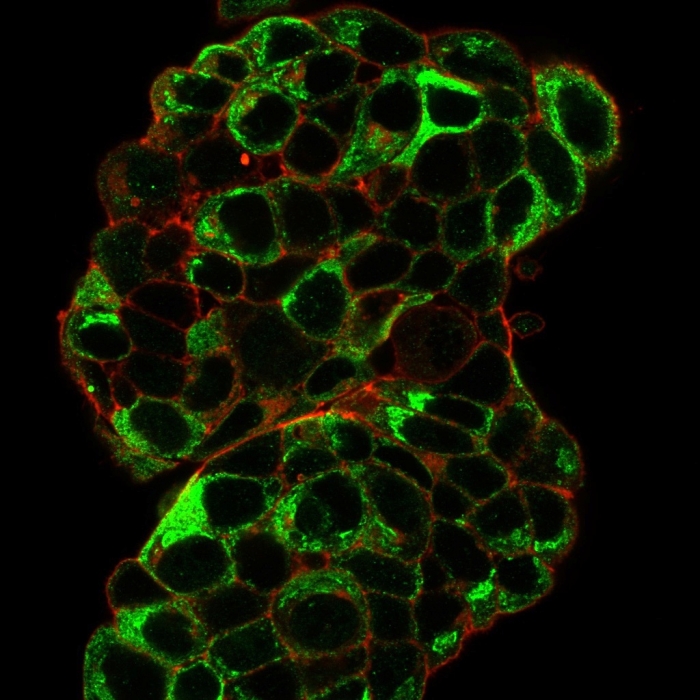 Immunocytochemistry/ Immunofluorescence - Anti-Estrogen Inducible Protein pS2 antibody [TFF1/2133] (AB268118), expandable thumbnail