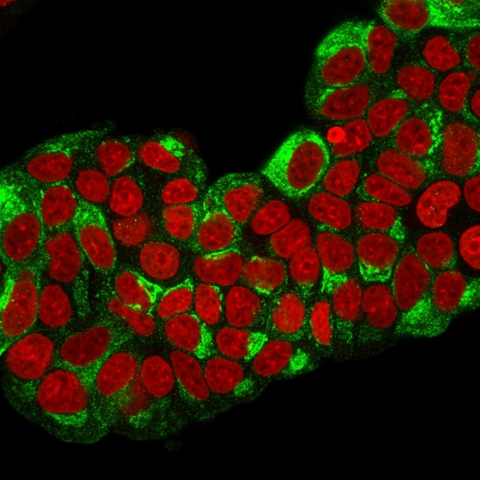 Immunocytochemistry/ Immunofluorescence - Anti-Estrogen Inducible Protein pS2 antibody [TFF1/2133] (AB268118), expandable thumbnail