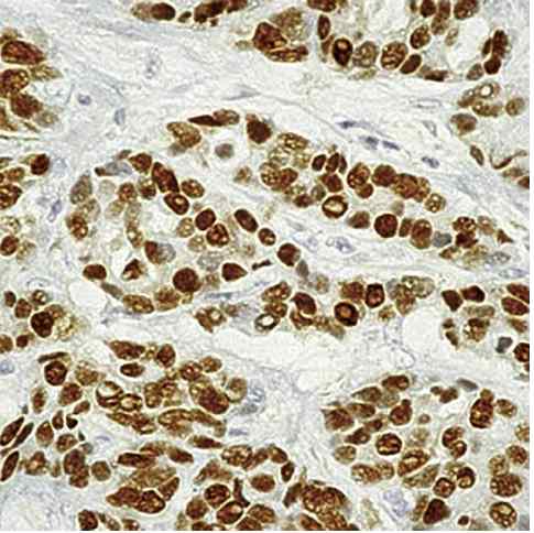 Immunohistochemistry (Formalin/PFA-fixed paraffin-embedded sections) - Anti-Estrogen Receptor alpha antibody [6F11] (AB93021)