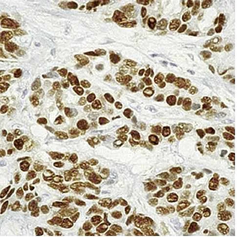 Immunohistochemistry (Formalin/PFA-fixed paraffin-embedded sections) - Anti-Estrogen Receptor alpha antibody [6F11] (AB93021)