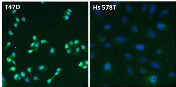 Immunocytochemistry/ Immunofluorescence - Anti-Estrogen Receptor alpha antibody (AB3575)