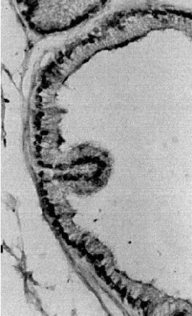 Immunohistochemistry (Formalin/PFA-fixed paraffin-embedded sections) - Anti-Estrogen Receptor alpha antibody (AB3575)