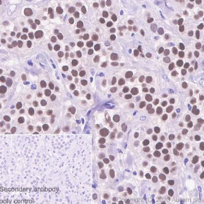 Immunohistochemistry (Formalin/PFA-fixed paraffin-embedded sections) - Anti-Estrogen Receptor alpha antibody [CRET94D] (AB241557)
