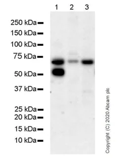 Western blot - Anti-Estrogen Receptor alpha antibody [CRET94D] (AB241557)