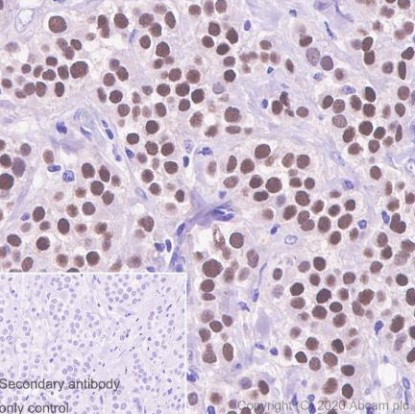 Immunohistochemistry (Formalin/PFA-fixed paraffin-embedded sections) - Anti-Estrogen Receptor alpha antibody [CRET94D] - BSA and Azide free (AB252794)