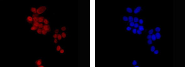 Immunocytochemistry/ Immunofluorescence - Anti-Estrogen Receptor alpha antibody [E115] - BSA and Azide free (ab271827), expandable thumbnail