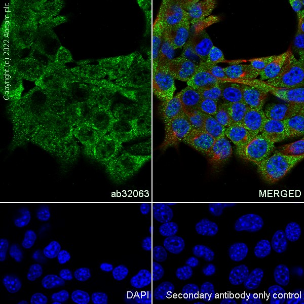 Immunocytochemistry/ Immunofluorescence - Anti-Estrogen Receptor alpha antibody [E115] - BSA and Azide free (ab271827), expandable thumbnail