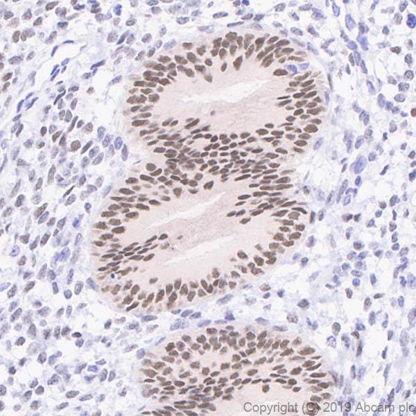 Immunohistochemistry (Formalin/PFA-fixed paraffin-embedded sections) - Anti-Estrogen Receptor alpha antibody [E115] - BSA and Azide free (AB271827), expandable thumbnail