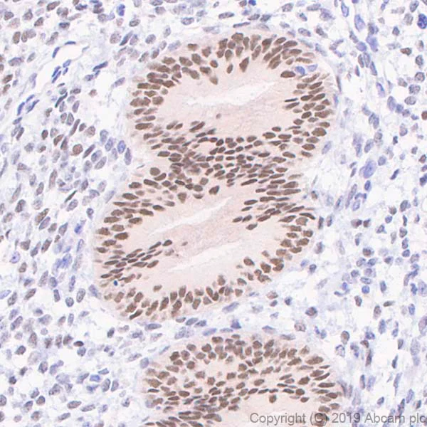 Immunohistochemistry (Formalin/PFA-fixed paraffin-embedded sections) - Anti-Estrogen Receptor alpha antibody [E115] - BSA and Azide free (AB271827)