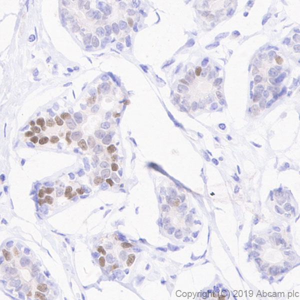 Immunohistochemistry (Formalin/PFA-fixed paraffin-embedded sections) - Anti-Estrogen Receptor alpha antibody [E115] - BSA and Azide free (ab271827), expandable thumbnail