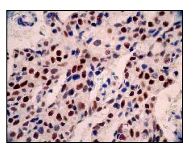 Immunohistochemistry (Formalin/PFA-fixed paraffin-embedded sections) - Anti-Estrogen Receptor alpha antibody [E115] - BSA and Azide free (ab271827), expandable thumbnail