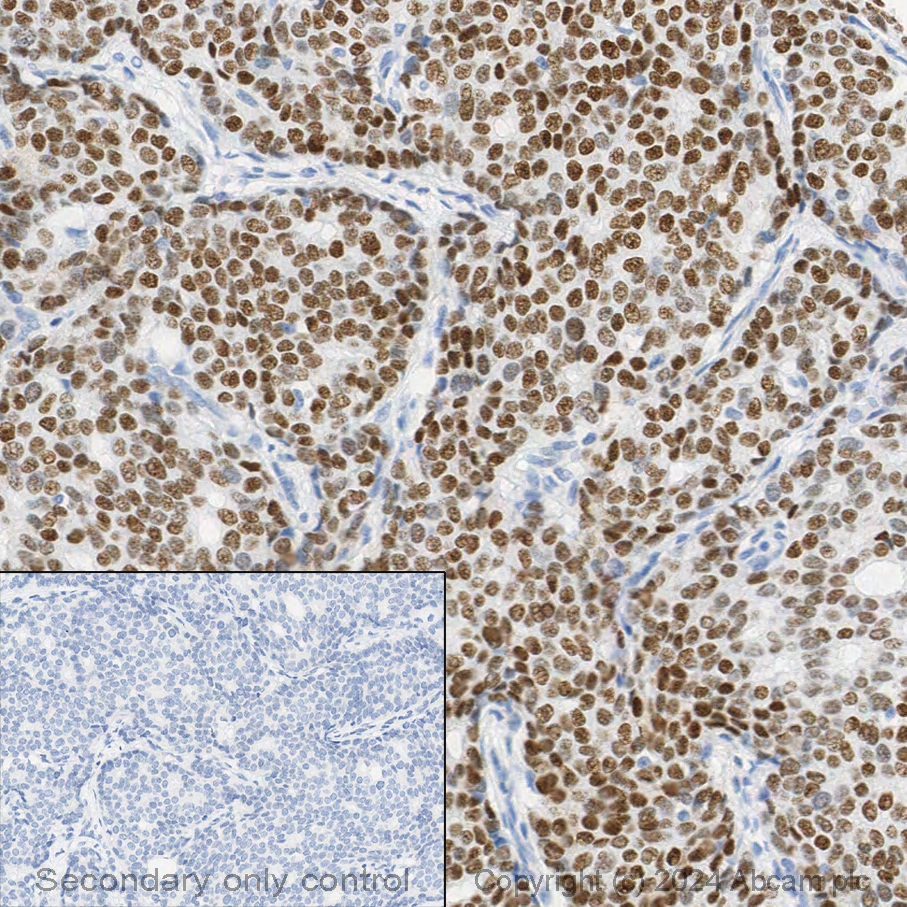 Immunohistochemistry (Formalin/PFA-fixed paraffin-embedded sections) - Anti-Estrogen Receptor alpha antibody [E115] - BSA and Azide free (ab271827), expandable thumbnail