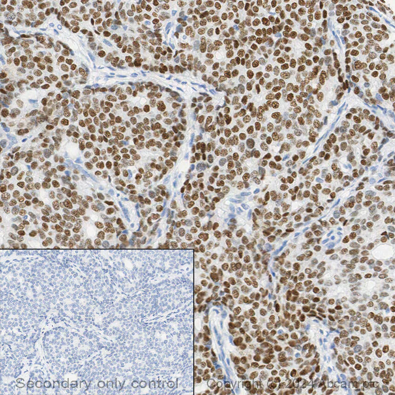 Immunohistochemistry (Formalin/PFA-fixed paraffin-embedded sections) - Anti-Estrogen Receptor alpha antibody [E115] - BSA and Azide free (AB271827)