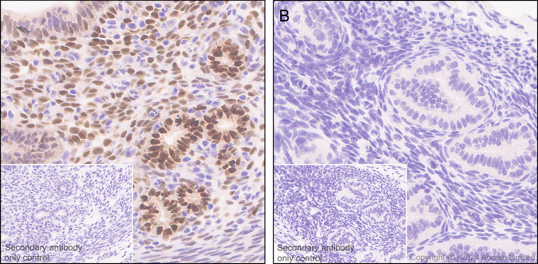 Immunohistochemistry (Formalin/PFA-fixed paraffin-embedded sections) - Anti-Estrogen Receptor alpha antibody [E115] - BSA and Azide free (ab271827), expandable thumbnail