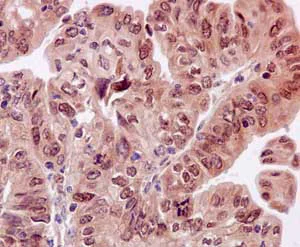 Immunohistochemistry (Formalin/PFA-fixed paraffin-embedded sections) - Anti-Estrogen Receptor alpha antibody [E115] - BSA and Azide free (AB271827)