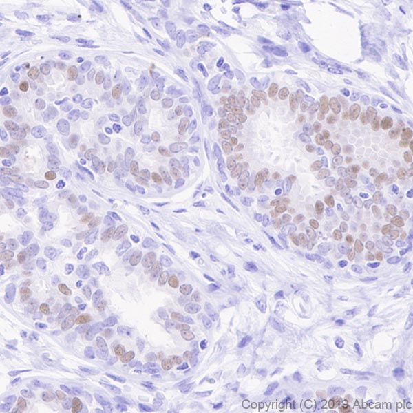 Immunohistochemistry (Formalin/PFA-fixed paraffin-embedded sections) - Anti-Estrogen Receptor alpha antibody [E115] - BSA and Azide free (ab271827), expandable thumbnail