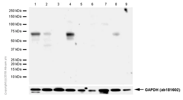 Western blot - Anti-Estrogen Receptor alpha antibody [E115] - BSA and Azide free (AB271827)