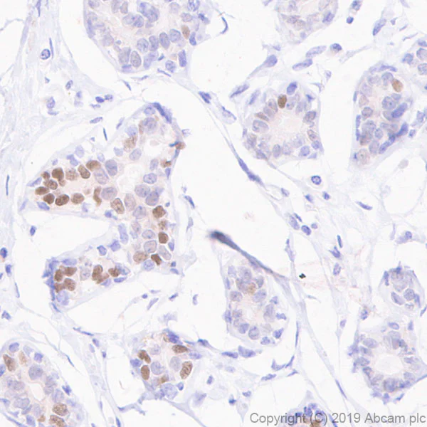 Immunohistochemistry (Formalin/PFA-fixed paraffin-embedded sections) - Anti-Estrogen Receptor alpha antibody [E115] - ChIP Grade (AB32063)