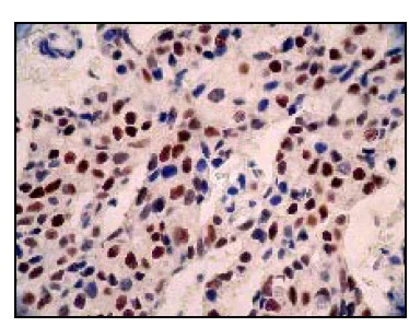 Immunohistochemistry (Formalin/PFA-fixed paraffin-embedded sections) - Anti-Estrogen Receptor alpha antibody [E115] - ChIP Grade (AB32063)