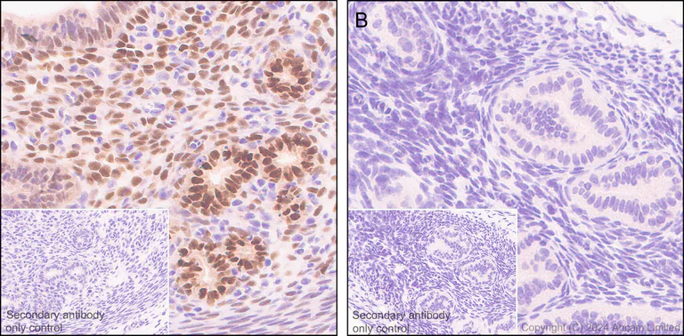 Immunohistochemistry (Formalin/PFA-fixed paraffin-embedded sections) - Anti-Estrogen Receptor alpha antibody [E115] - ChIP Grade (AB32063)