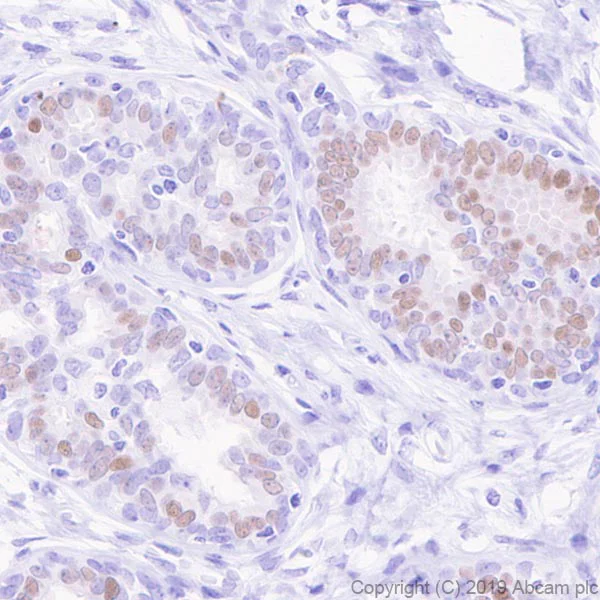 Immunohistochemistry (Formalin/PFA-fixed paraffin-embedded sections) - Anti-Estrogen Receptor alpha antibody [E115] - ChIP Grade (AB32063)