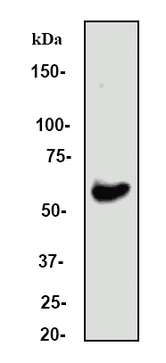 Western blot - Anti-Estrogen Receptor alpha antibody [E115] - ChIP Grade (ab32063), expandable thumbnail