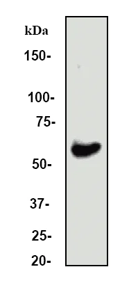 Western blot - Anti-Estrogen Receptor alpha antibody [E115] - ChIP Grade (AB32063)