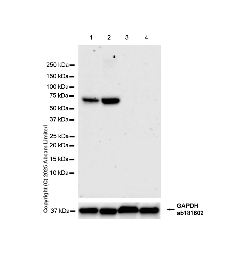 Western blot - Anti-Estrogen Receptor alpha antibody [E115] - ChIP Grade (AB32063)