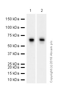 Western blot - Anti-Estrogen Receptor alpha antibody [E115] - ChIP Grade (ab32063), expandable thumbnail