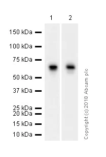 Western blot - Anti-Estrogen Receptor alpha antibody [E115] - ChIP Grade (AB32063)
