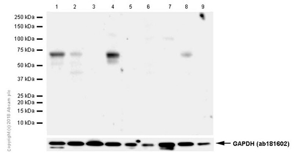 Western blot - Anti-Estrogen Receptor alpha antibody [E115] - ChIP Grade (ab32063), expandable thumbnail