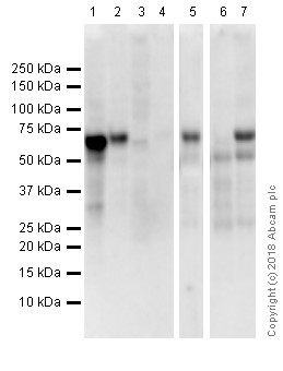 Western blot - Anti-Estrogen Receptor alpha antibody [E115] - ChIP Grade (ab32063), expandable thumbnail