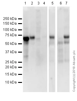 Western blot - Anti-Estrogen Receptor alpha antibody [E115] - ChIP Grade (AB32063)