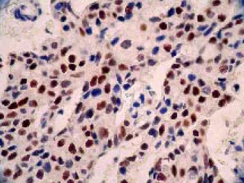 Immunohistochemistry (Formalin/PFA-fixed paraffin-embedded sections) - Anti-Estrogen Receptor alpha antibody [E115] - Low endotoxin, Azide free (AB167611)
