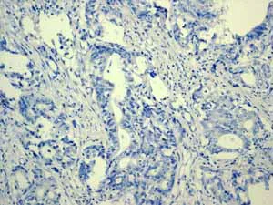 Immunohistochemistry (Formalin/PFA-fixed paraffin-embedded sections) - Anti-Estrogen Receptor alpha antibody [EPR4097] (AB108398)