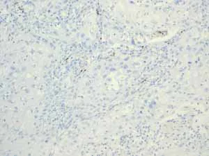 Immunohistochemistry (Formalin/PFA-fixed paraffin-embedded sections) - Anti-Estrogen Receptor alpha antibody [EPR4097] (AB108398)