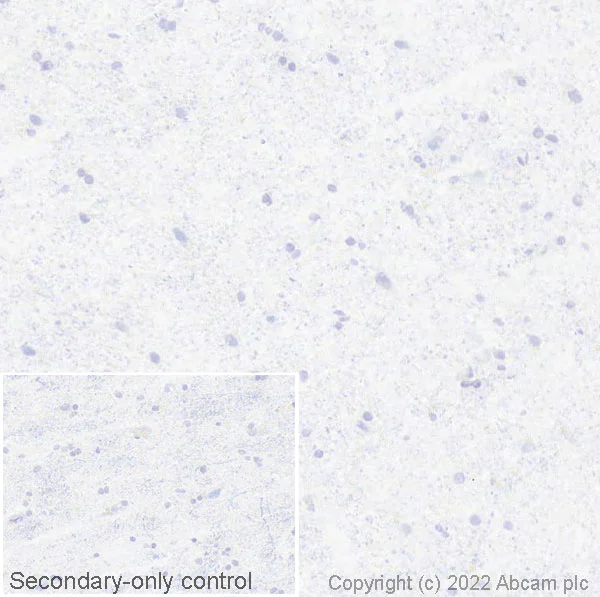 Immunohistochemistry (Frozen sections) - Anti-Estrogen Receptor alpha antibody [EPR4097] (AB108398)