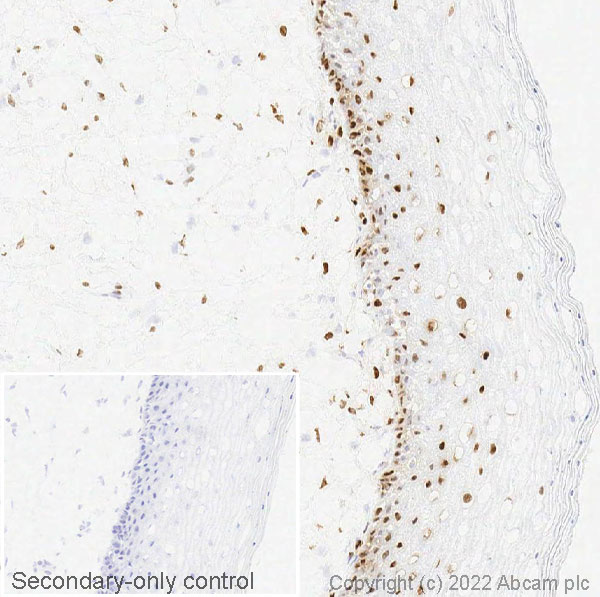 Immunohistochemistry (Frozen sections) - Anti-Estrogen Receptor alpha antibody [EPR4097] (AB108398)