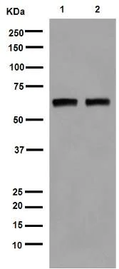 Western blot - Anti-Estrogen Receptor alpha antibody [EPR4097] (AB108398)