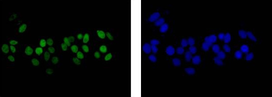 Immunocytochemistry/ Immunofluorescence - Anti-Estrogen Receptor alpha antibody [EPR4097] - BSA and Azide free (AB167610), expandable thumbnail