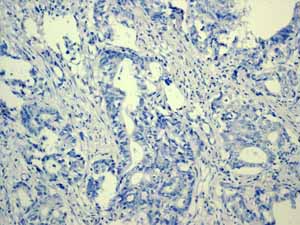Immunohistochemistry (Formalin/PFA-fixed paraffin-embedded sections) - Anti-Estrogen Receptor alpha antibody [EPR4097] - BSA and Azide free (ab167610), expandable thumbnail