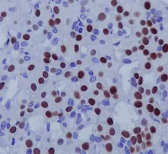 Immunohistochemistry (Formalin/PFA-fixed paraffin-embedded sections) - Anti-Estrogen Receptor alpha antibody [EPR4097] - BSA and Azide free (AB167610)