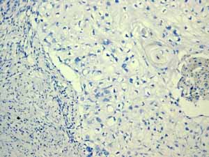 Immunohistochemistry (Formalin/PFA-fixed paraffin-embedded sections) - Anti-Estrogen Receptor alpha antibody [EPR4097] - BSA and Azide free (ab167610), expandable thumbnail