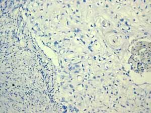 Immunohistochemistry (Formalin/PFA-fixed paraffin-embedded sections) - Anti-Estrogen Receptor alpha antibody [EPR4097] - BSA and Azide free (AB167610)