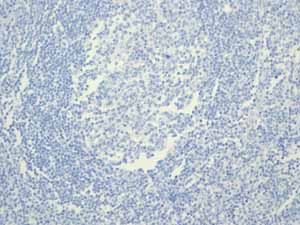 Immunohistochemistry (Formalin/PFA-fixed paraffin-embedded sections) - Anti-Estrogen Receptor alpha antibody [EPR4097] - BSA and Azide free (ab167610), expandable thumbnail