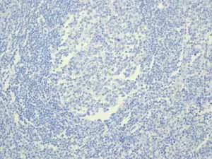 Immunohistochemistry (Formalin/PFA-fixed paraffin-embedded sections) - Anti-Estrogen Receptor alpha antibody [EPR4097] - BSA and Azide free (AB167610)